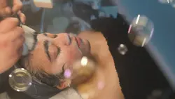 Acne treatment 