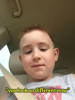 Glow up transition