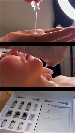 Microneedling