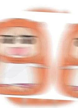 응애
