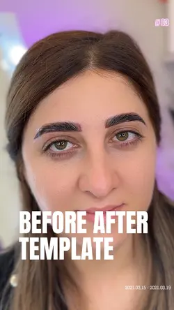 BEFORE AFTER