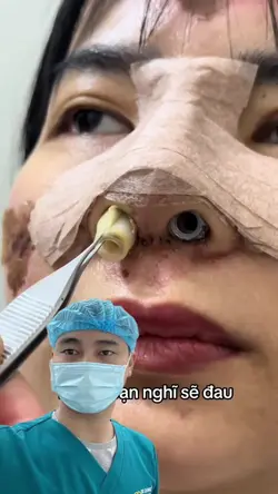 Thêm 3 đoạn video