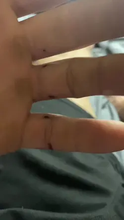 Add 1 clip
