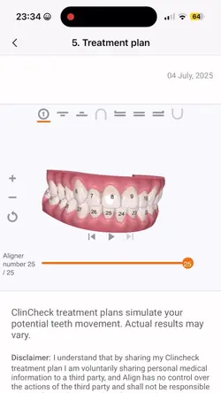 Add 9 clips